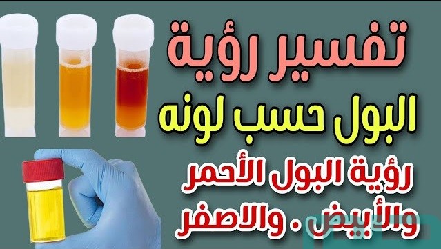 تفسير تغير لون البول في المنام