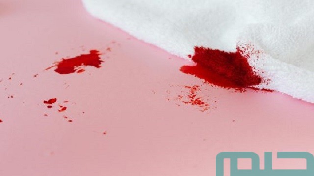 تفسير حلم الإجهاض ورؤية الدم