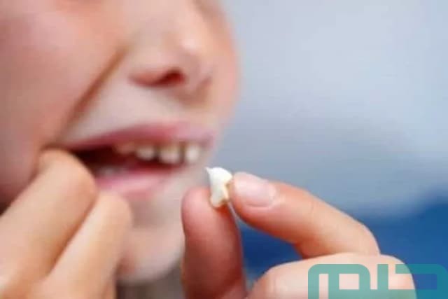 تفسير حلم خلع الأسنان باليد تفسير حلم خلع الأسنان باليد