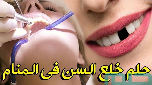 تفسير حلم خلع السن للعزباء ابن سيرين