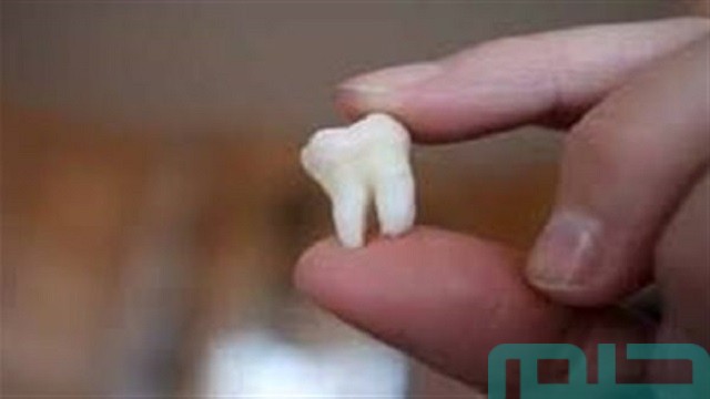  تفسير حلم سقوط ضرس مسوس