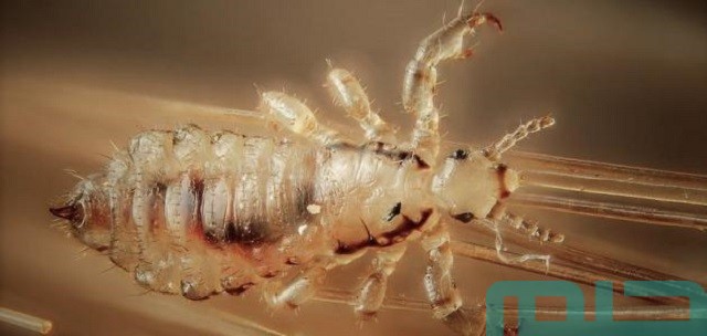 حلم القمل في الشعر للمتزوجه حلم القمل في الشعر للمتزوجه