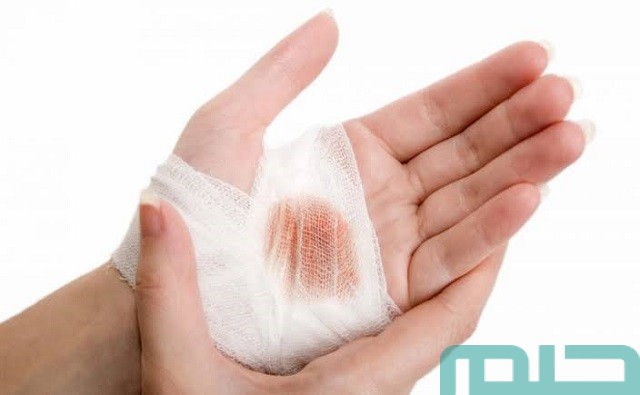 ما تفسير رؤية ابني مجروح في المنام؟