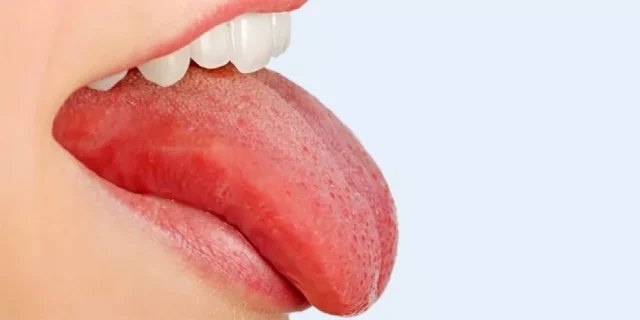 تفسير حلم رؤية اللسان المقطوع في المنام تفسير حلم رؤية اللسان المقطوع في المنام