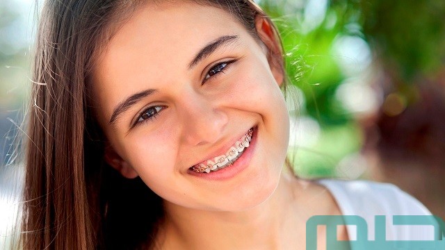 تفسير حلم رؤية الابتسامة في المنام تفسير حلم رؤية الابتسامة في المنام