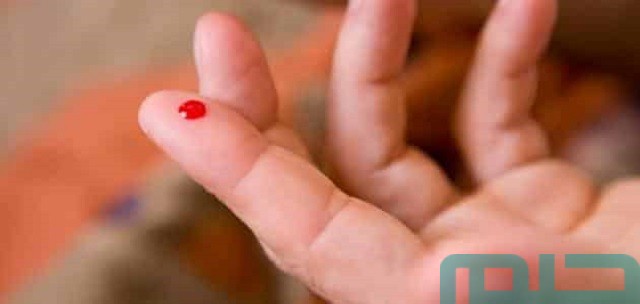 تفسير حلم رؤية رجل ضخم ينزف تفسير حلم رؤية رجل ضخم ينزف