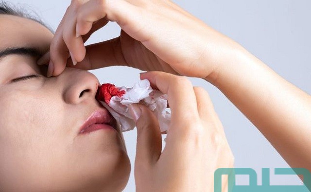 تفسير حلم رؤية نزول دم من الأنف تفسير حلم رؤية نزول دم من الأنف